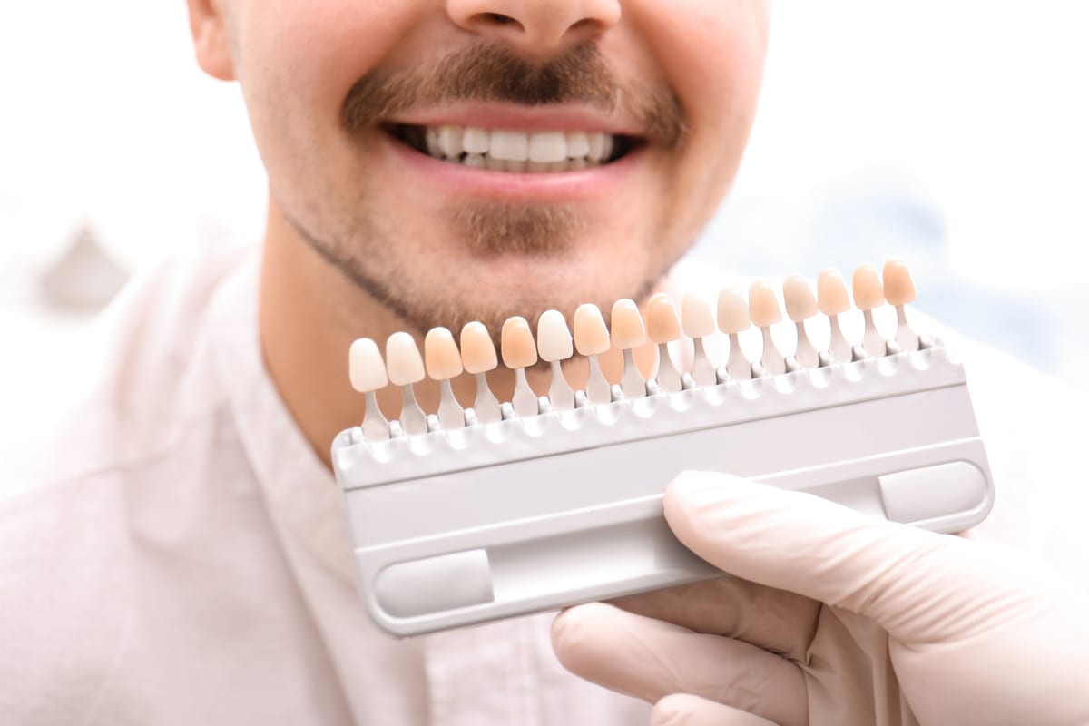 Veneers in Morrisville