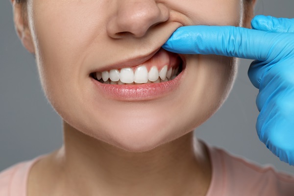 Gum Disease Treatment: What To Expect From Start To Finish